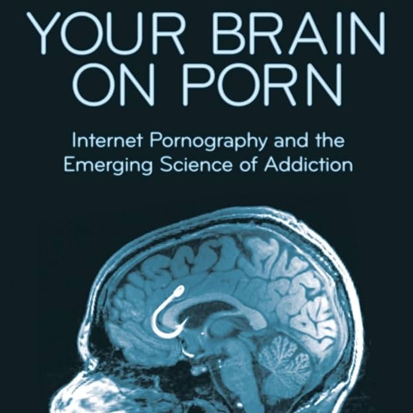 Your Brain on Porn: Internet Pornography and the Emerging Science of Addiction