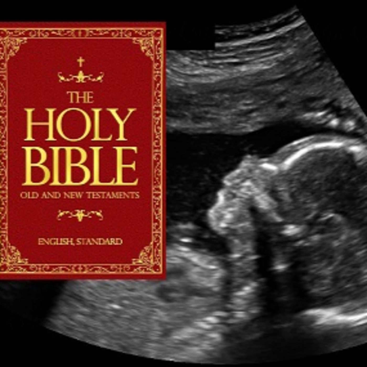 Episode 79: The Bible And: Abortion
