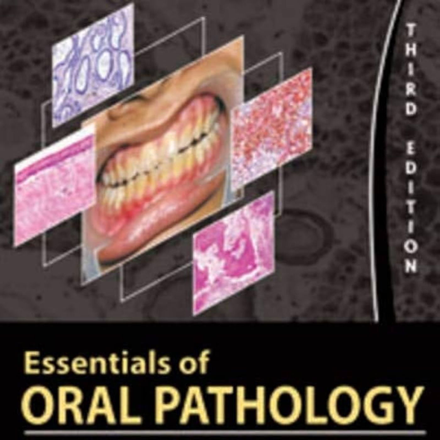 Essentials of Oral Pathology