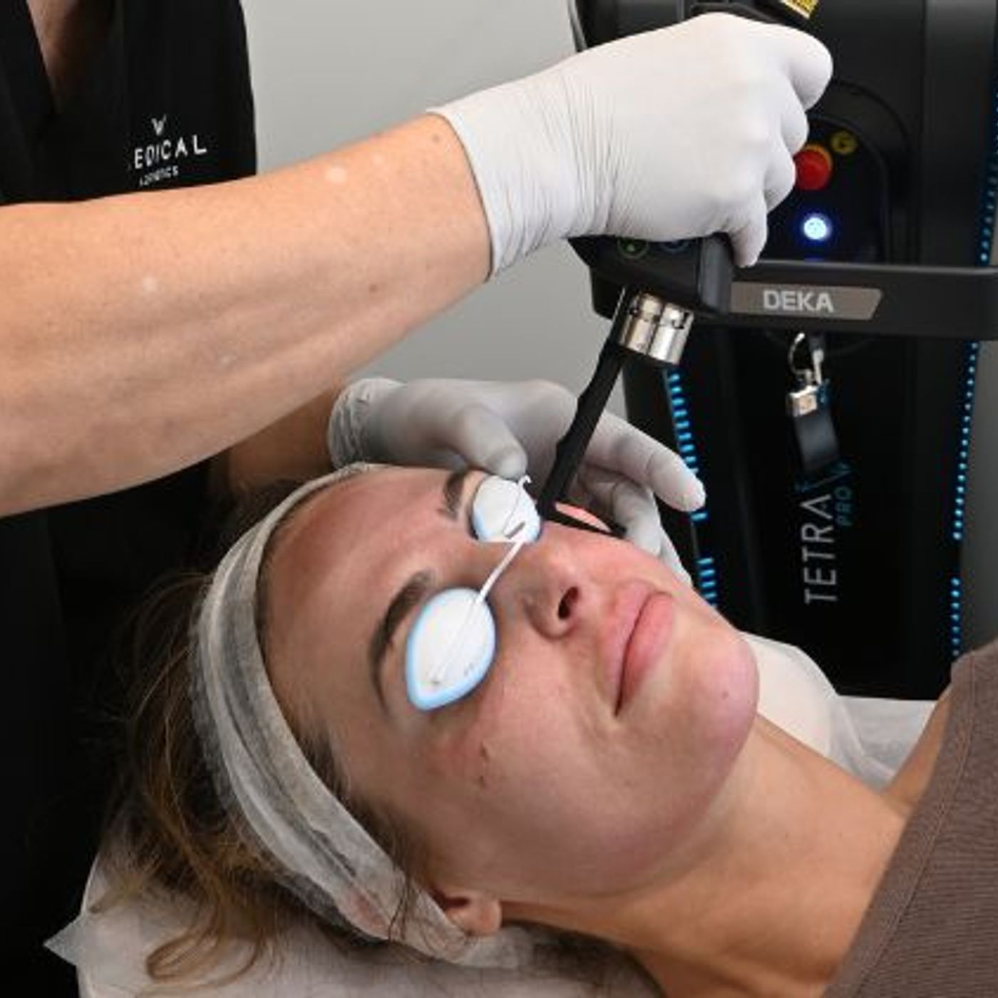 CO2 Laser for Wrinkles Which Lines May Respond to Resurfacing episode artwork