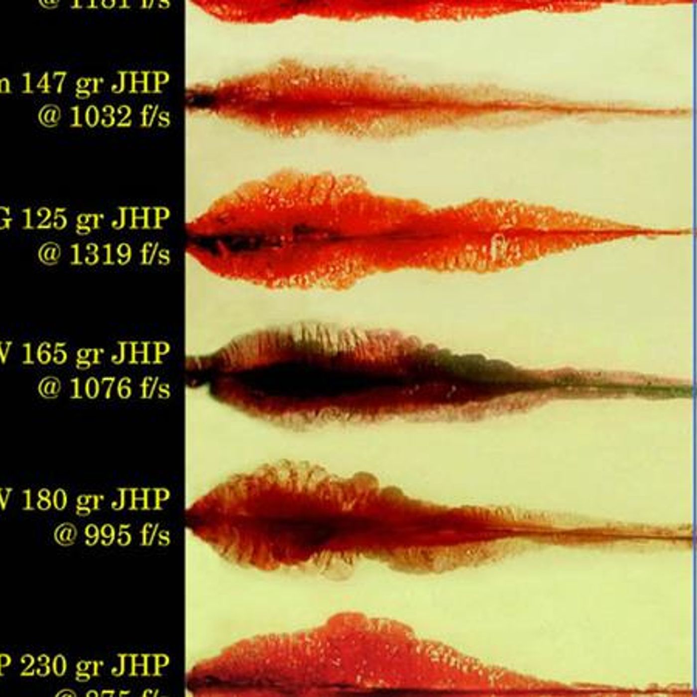 Survival Medicine Hour: Ballistic Trauma, Fat Intake, Styes, and more