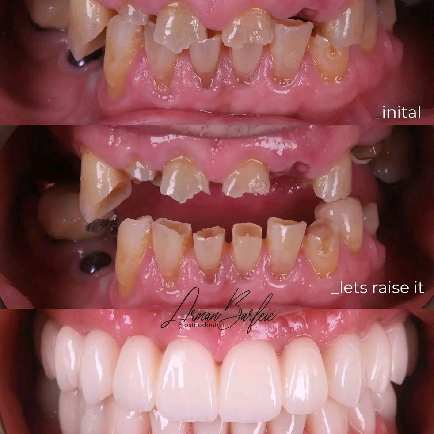 Salud Periodontal y Enfermades Cronicas