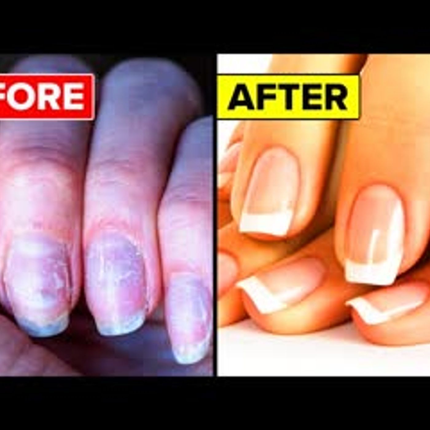 10 Tips To Make Your Nails Grow STRONGER And Longer FAST! episode artwork