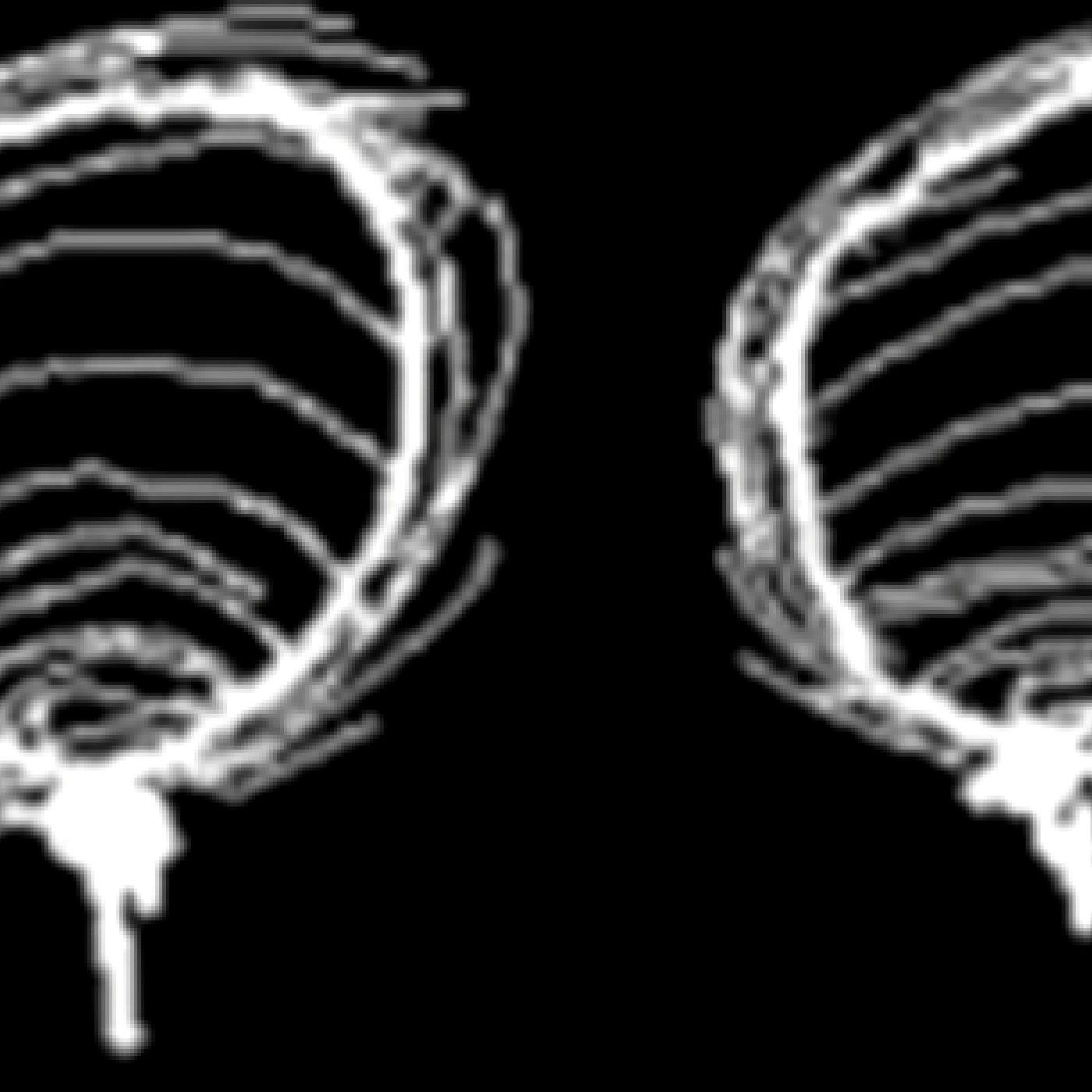 Floob's Song Palace podcast artwork
