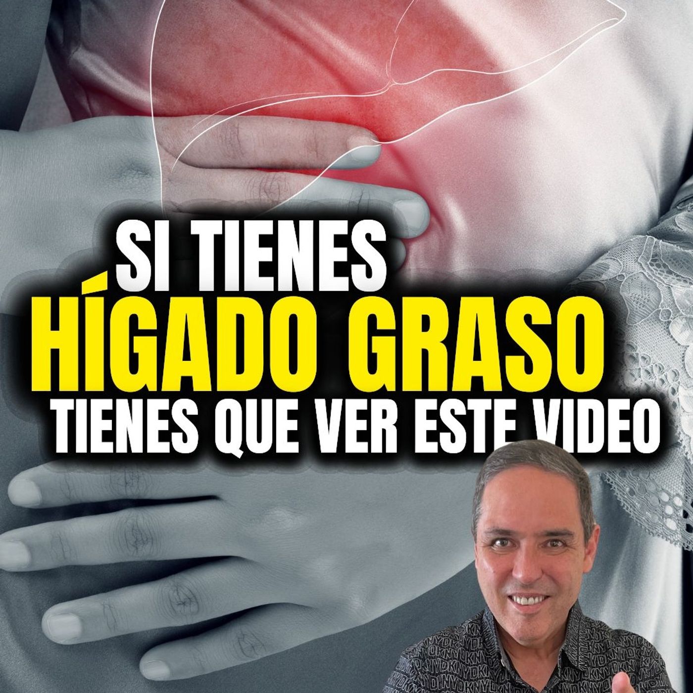 HIGADO GRASO