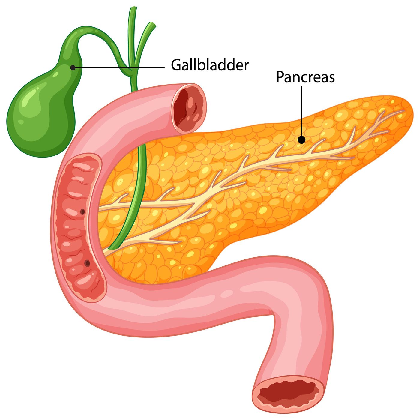 Pancreatite episode artwork