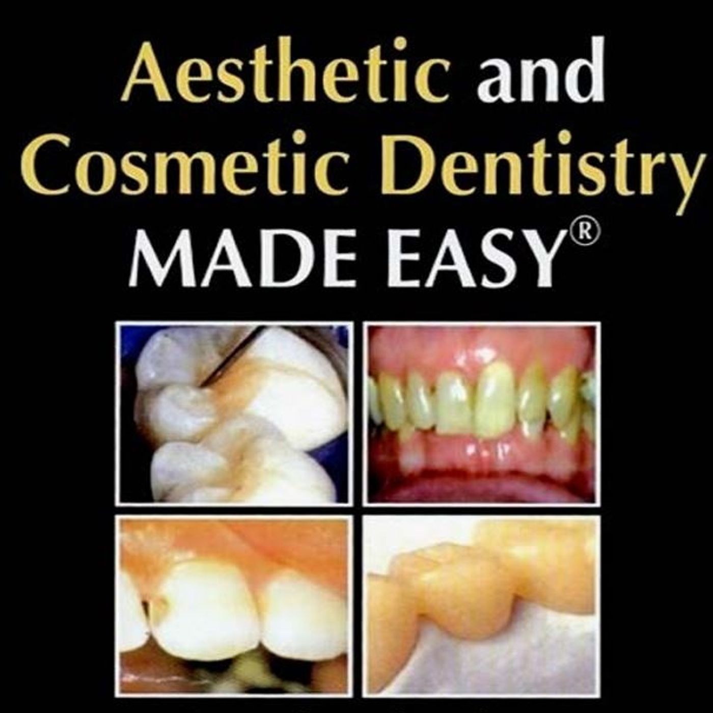 Aesthetic and Cosmetic Dentistry Made Easy