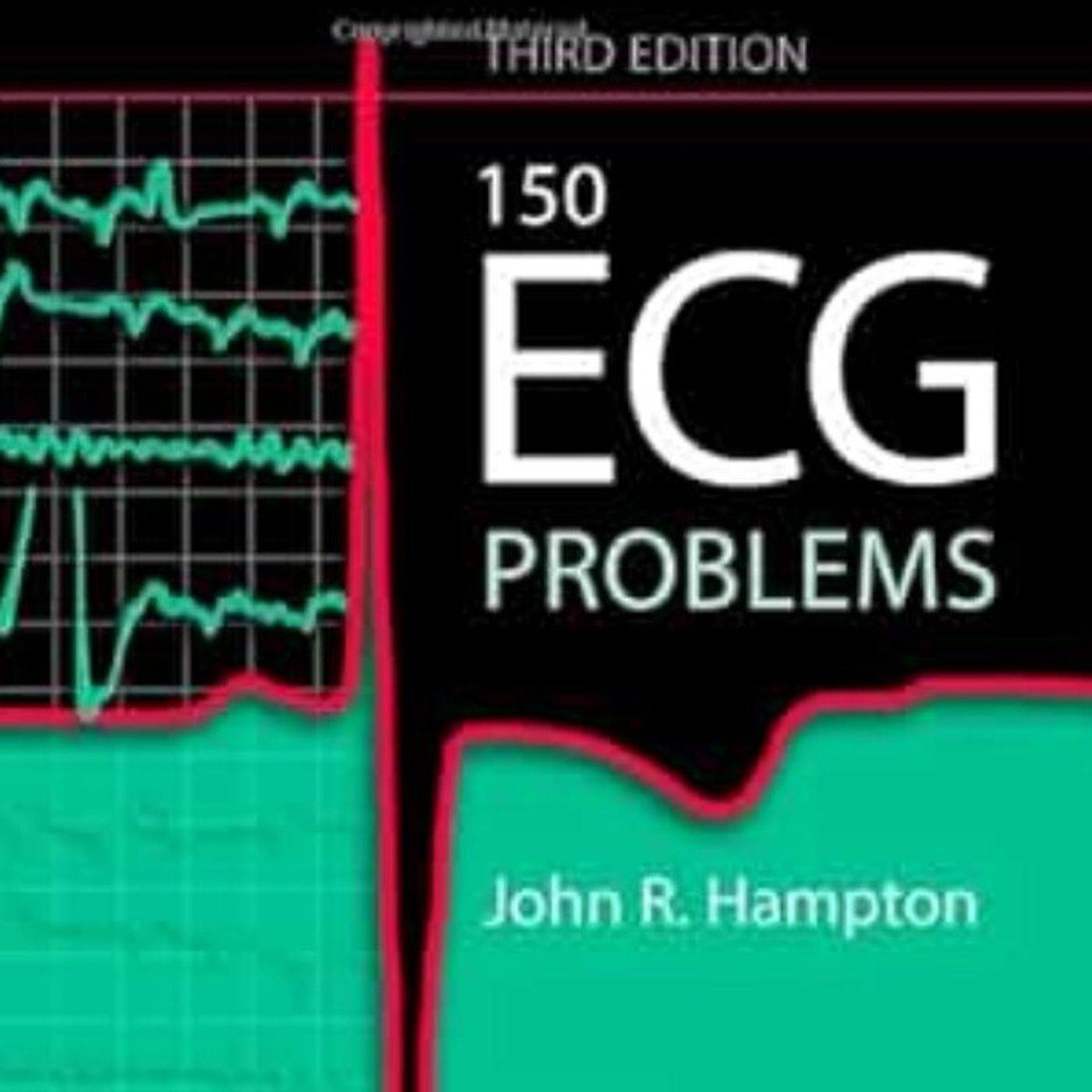 150 ECG Problems episode artwork