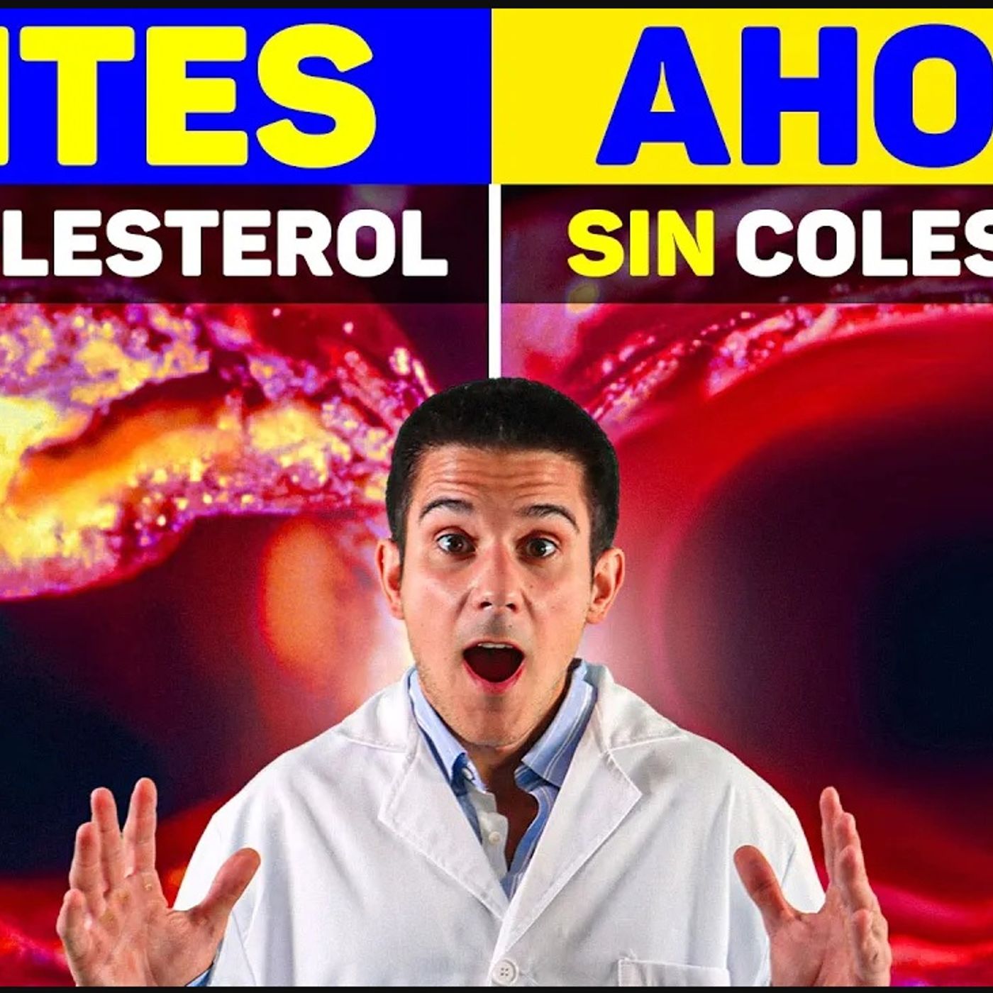 🩺EVITA las PLACAS de GRASA en tus ARTERIAS ASÍ (COLESTEROL, ApoB, INFLAMACIÓN y LP-A)