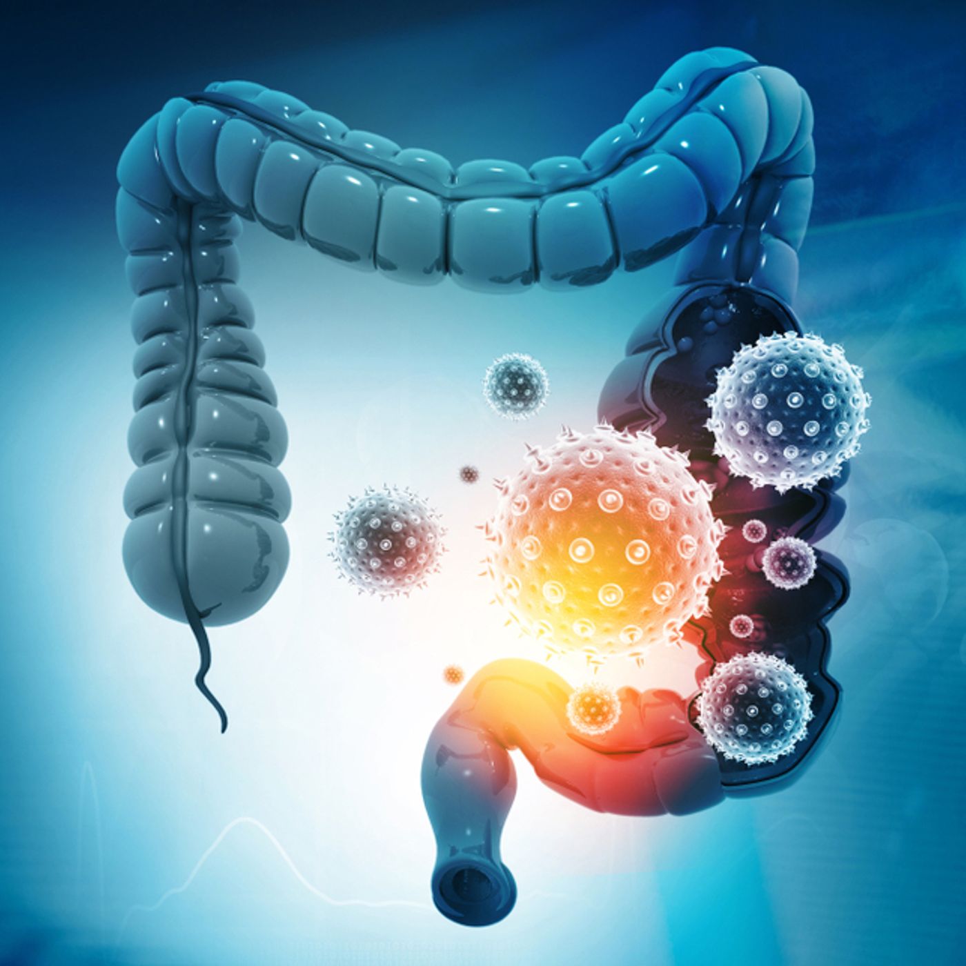 Allenamento contro il cancro del colon episode artwork