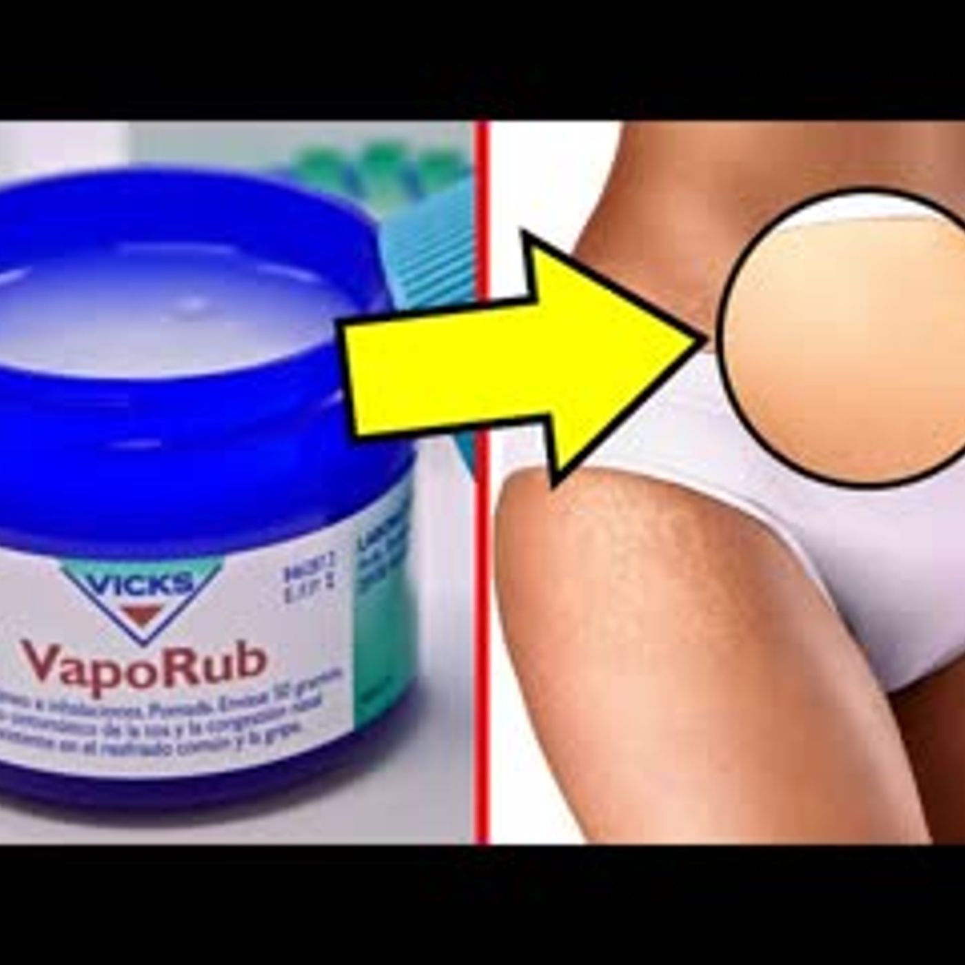11 Unexpected Uses & Benefits Of Vicks VapoRub You Must Know episode artwork