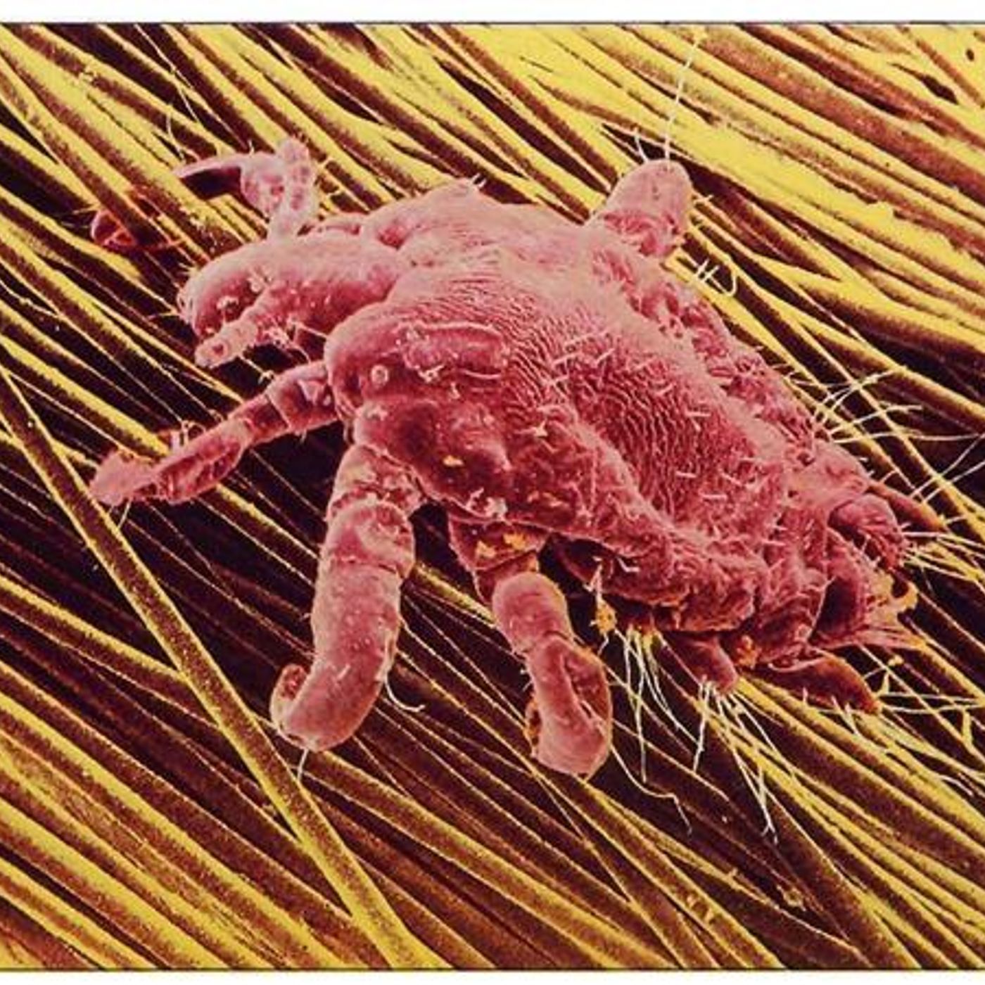 Survival Medicine Hour: Tornadoes, Lice, Dental Hygiene in Austere Settings