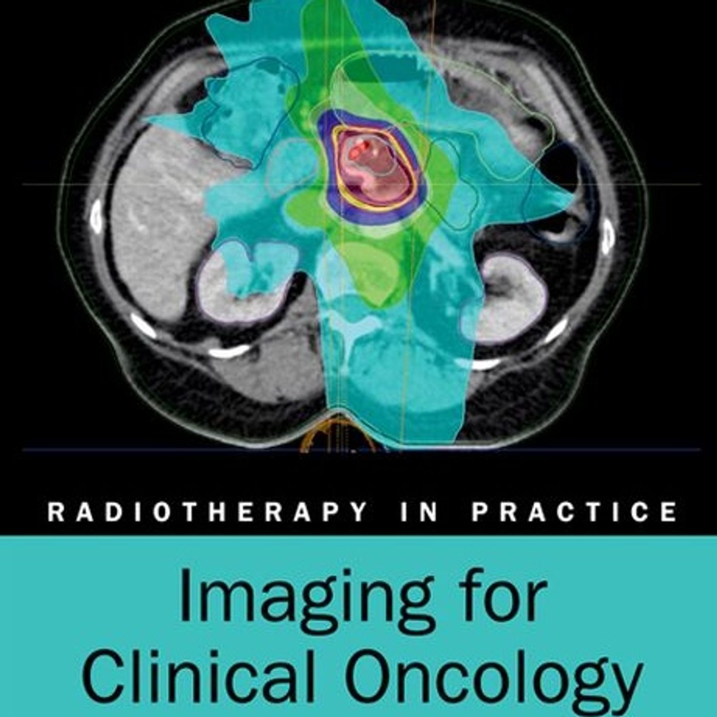 Radiotherapy in Practice: Imaging for Clinical Oncology