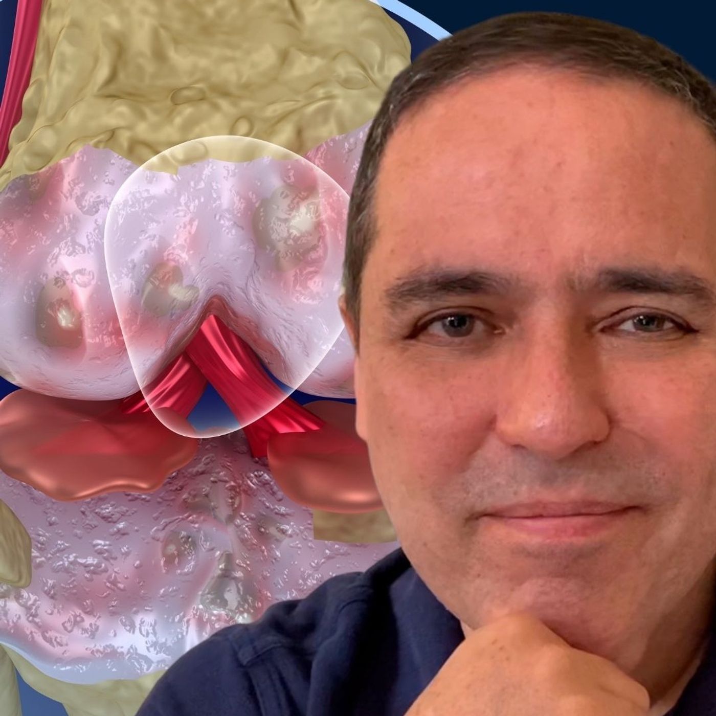 HABLEMOS DE ARTRITIS...