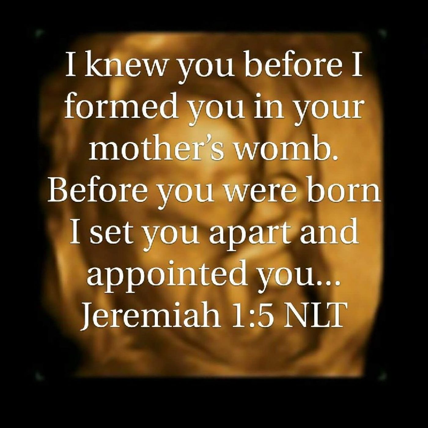 P.1 I WAS HELD BY YAHWEH BEFORE MY OWN MOTHER KNEW ME! episode artwork