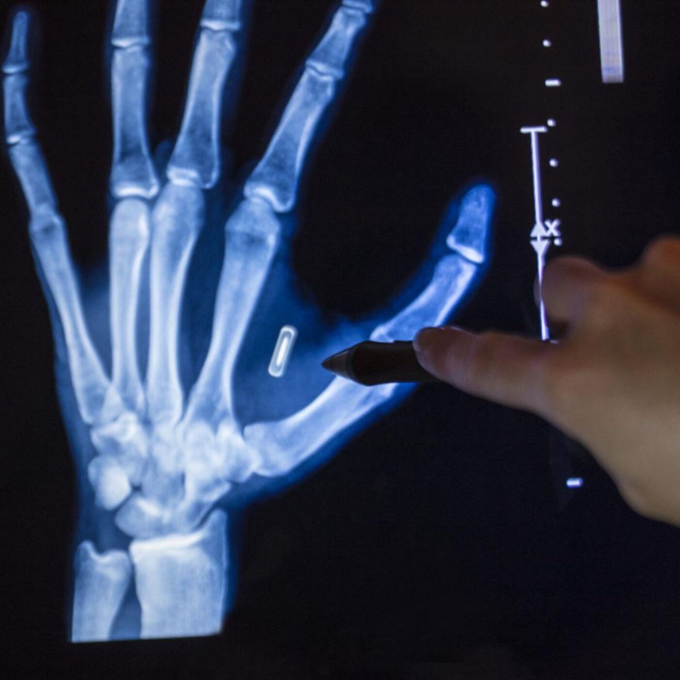 S9: The Invisible Crime: Illegal Microchip Implants and Microwave Technology - Replay