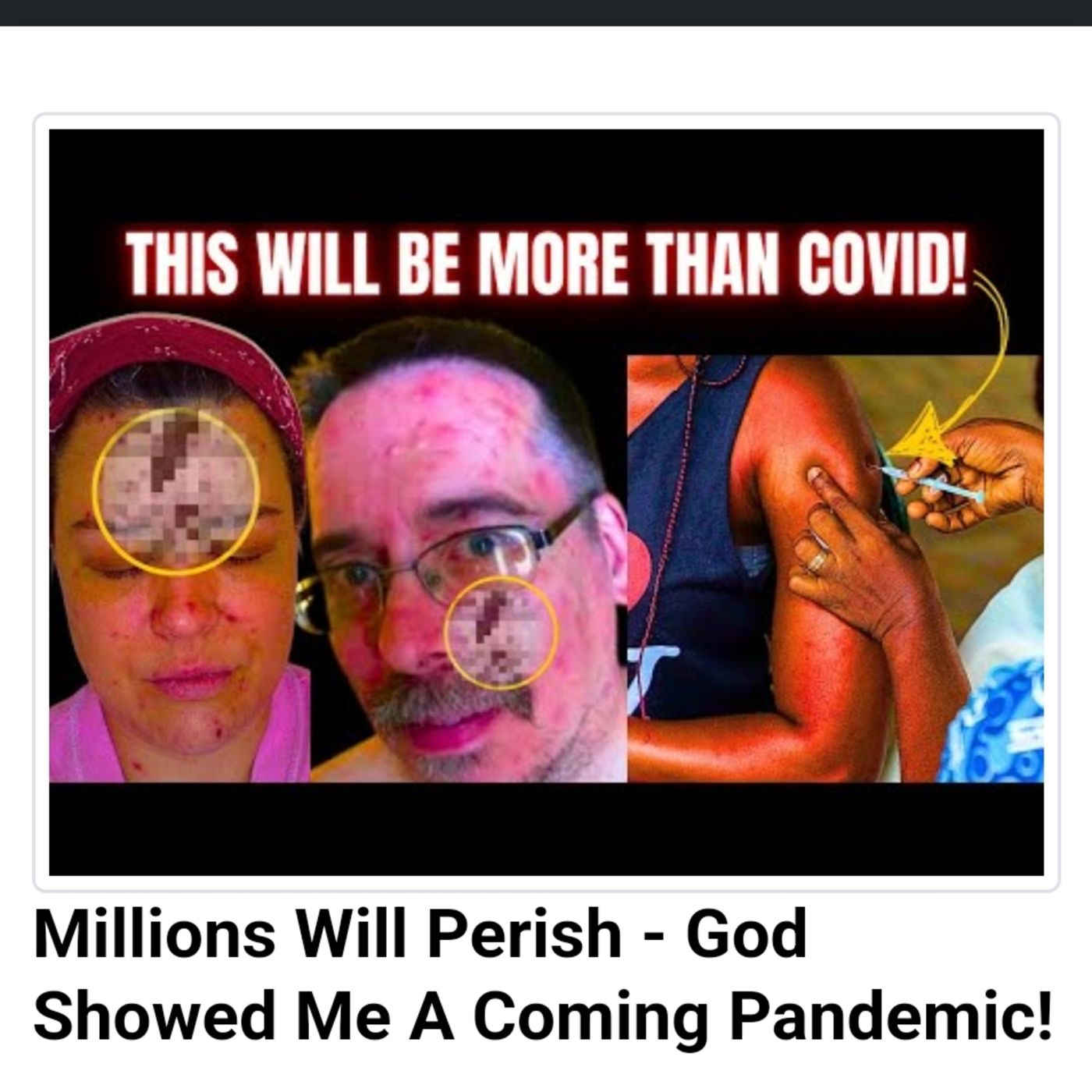Millions Will Perish - God Showed Me A Coming Pandemic! episode artwork