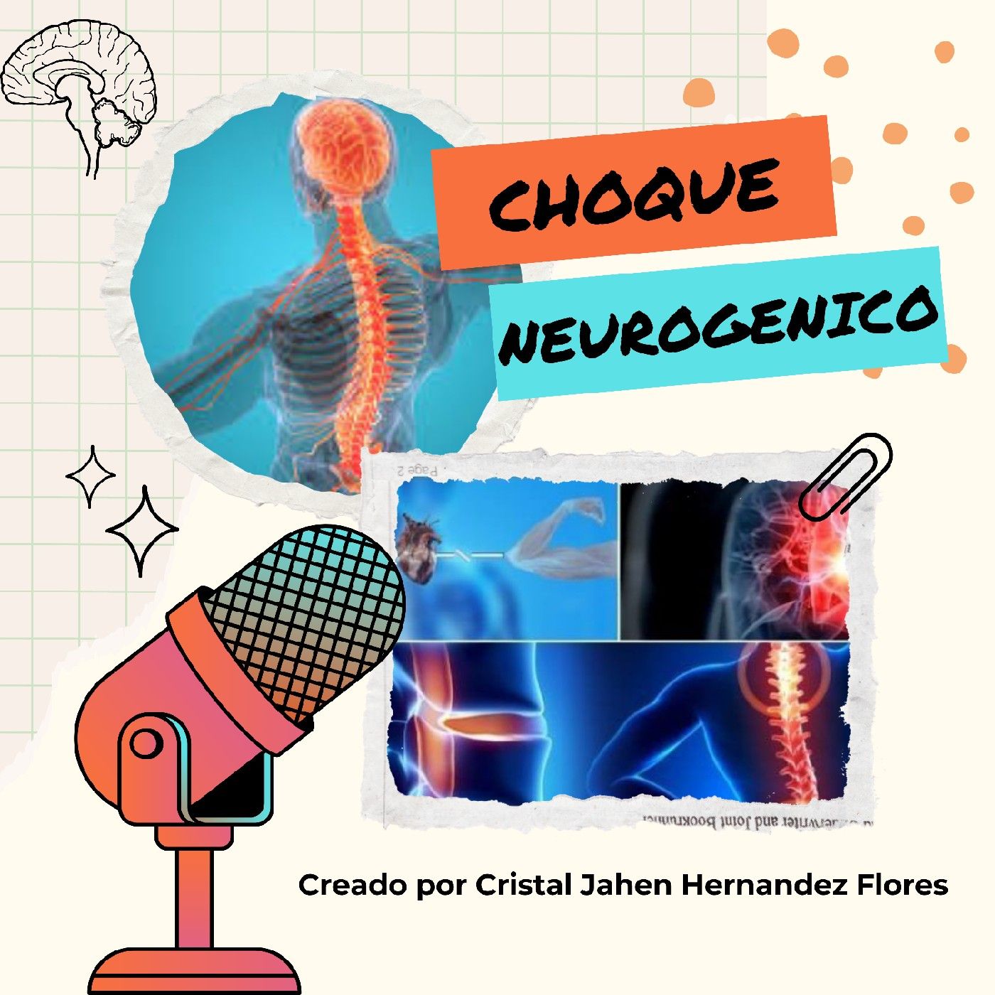Choque Neurogenico