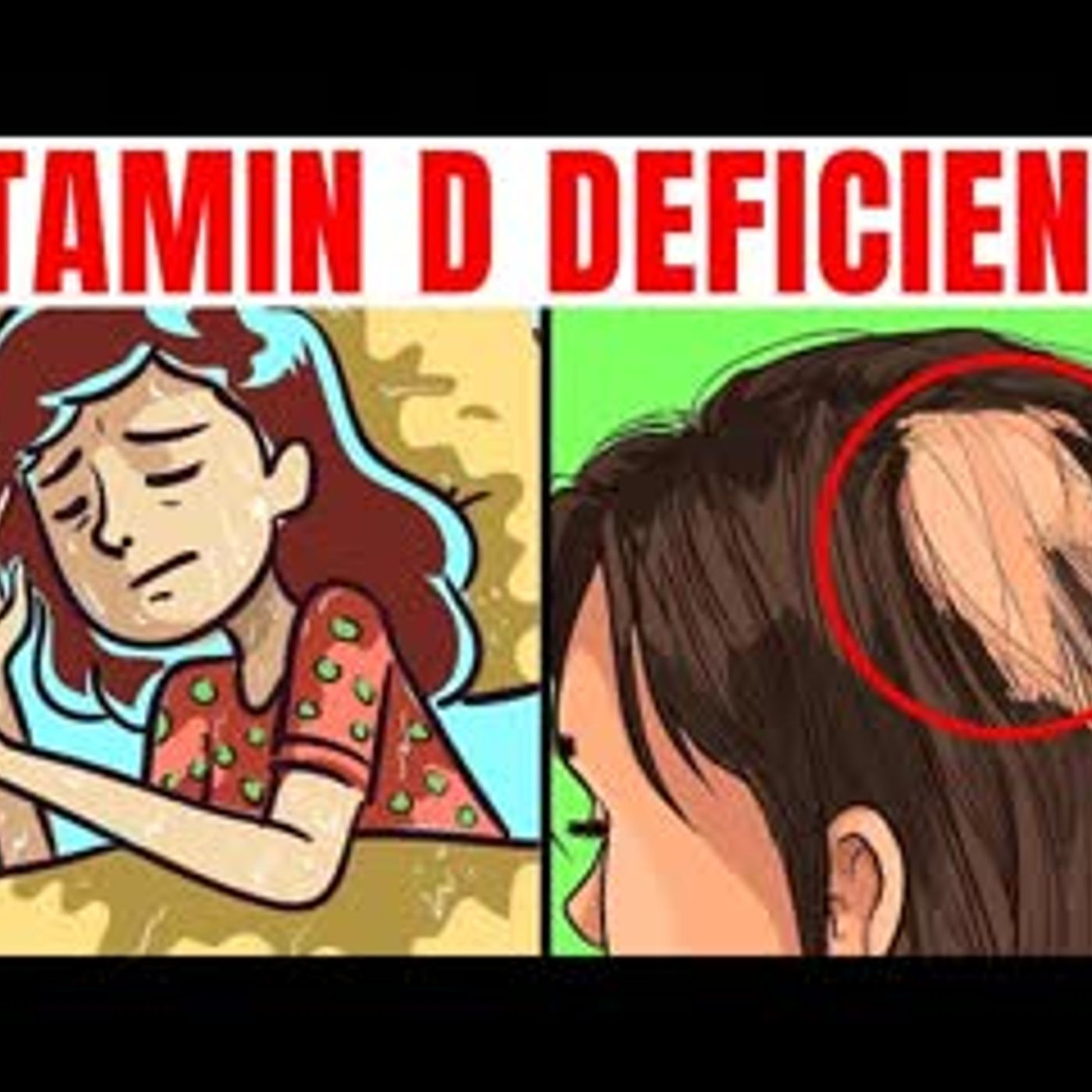 14 Signs Of Vitamin D Deficiency Your Body Is Warning You About episode artwork