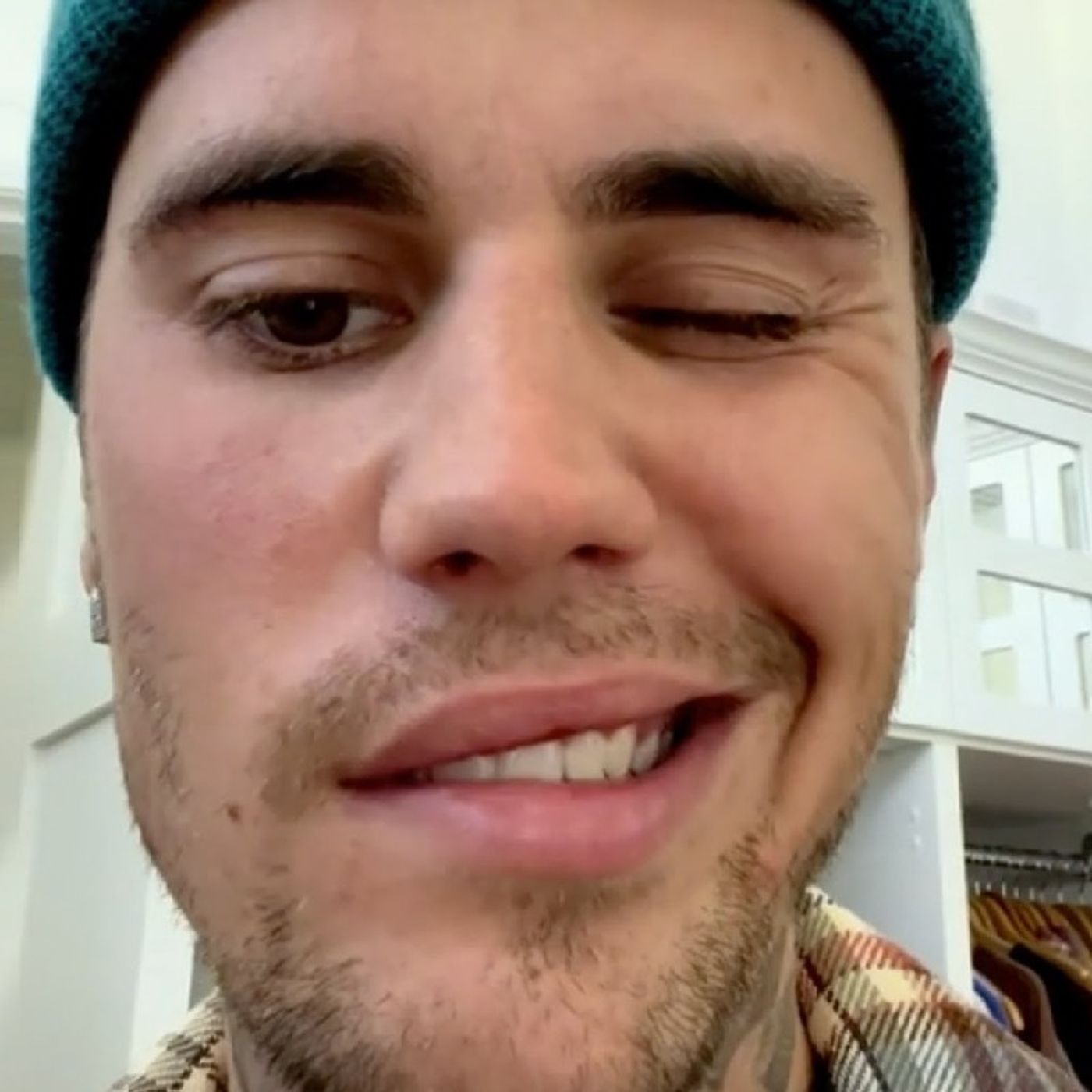 Justin Beiber Reveals He Has Ramsey Hunt Syndrome And His Face Is Partially Paralyzed episode artwork