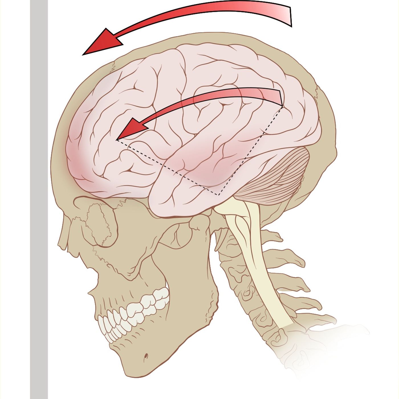 Episode 107: Rugby's concussion and head injury conundrum