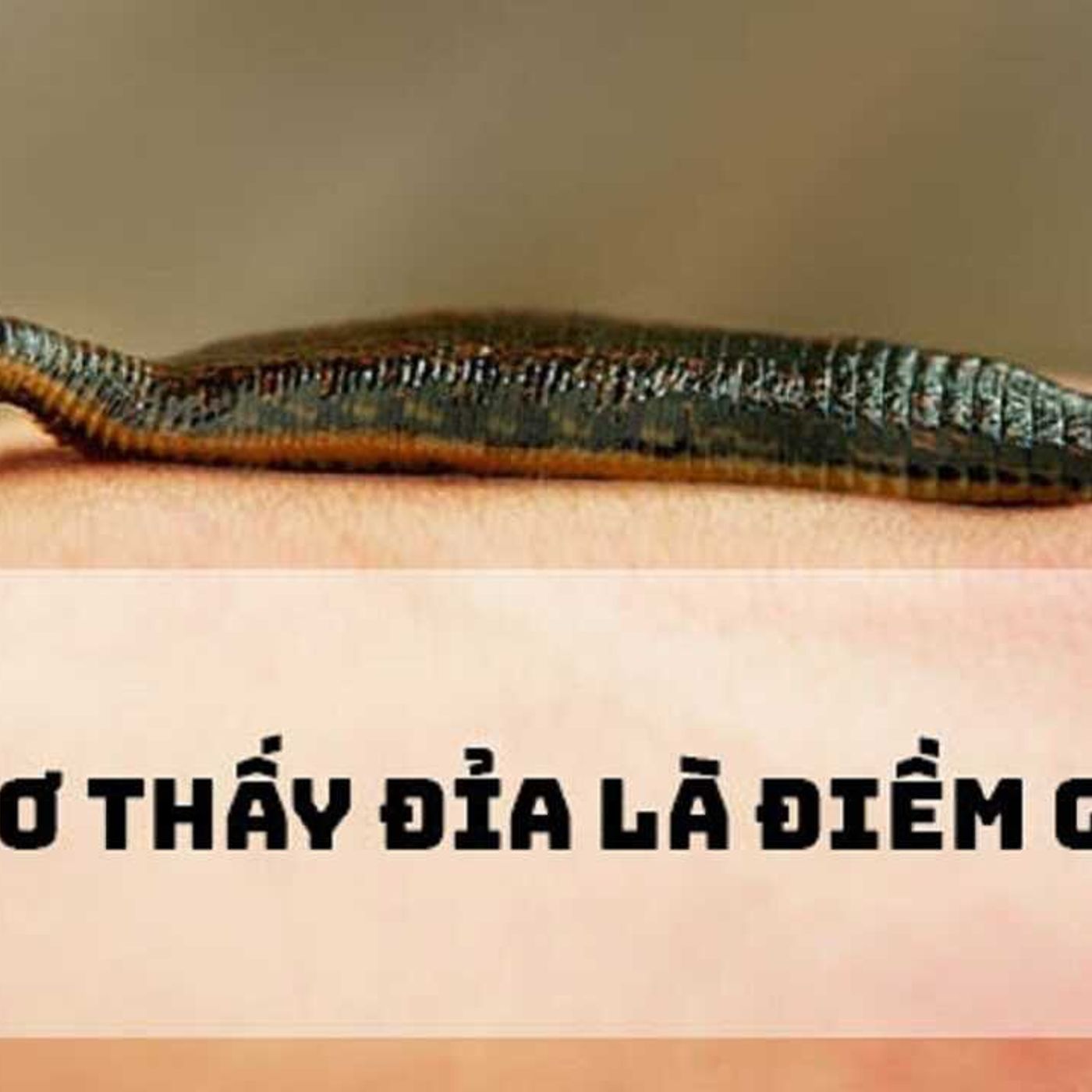 Mơ Thấy Con Đỉa: Dấu Hiệu Của May Mắn Hay Rắc Rối? episode artwork