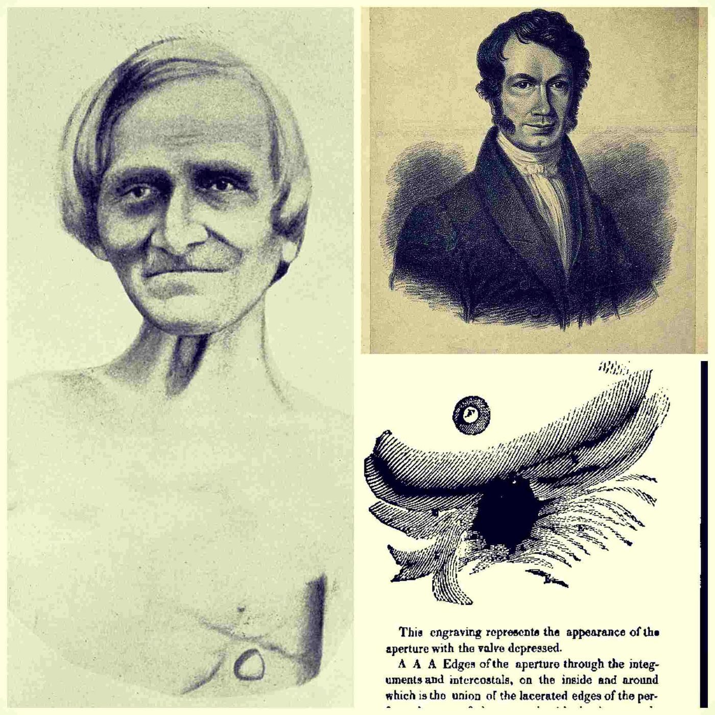 Pillole di Storia della Medicina
