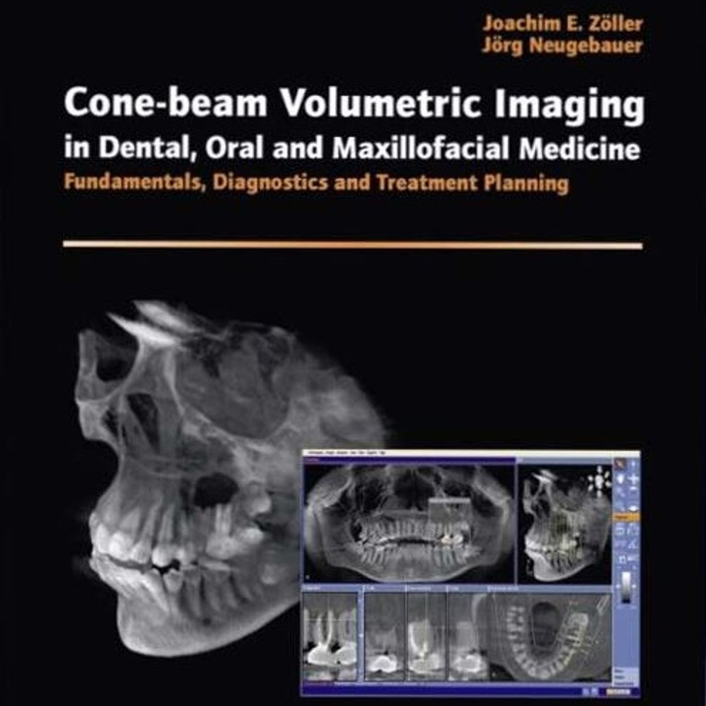 Cone-beam Volumetric Imaging in Dental, Oral and Maxillofacial Medicine:  Fundamentals, Diagnostics and Treatment Planning
