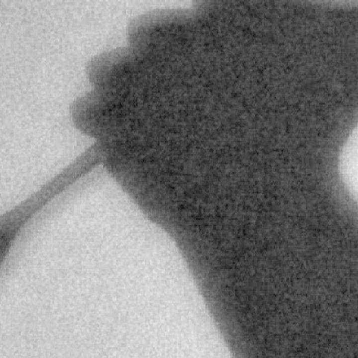 Choc a Giugliano: ferisce il fratello di 14 anni per punire il nonno: arrestato 20enne