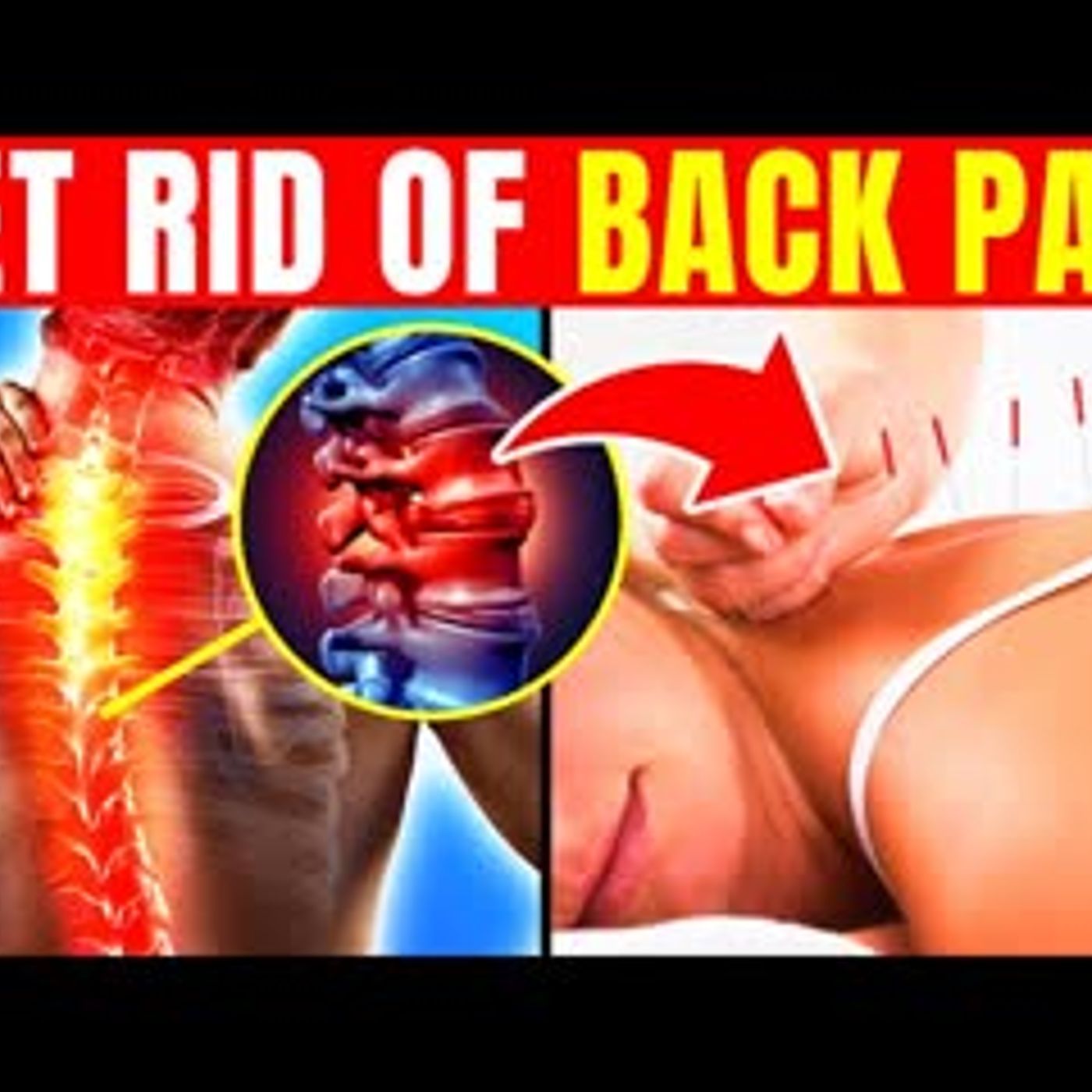 12 Ways To Treat Chronic Back Pain Without Surgery episode artwork