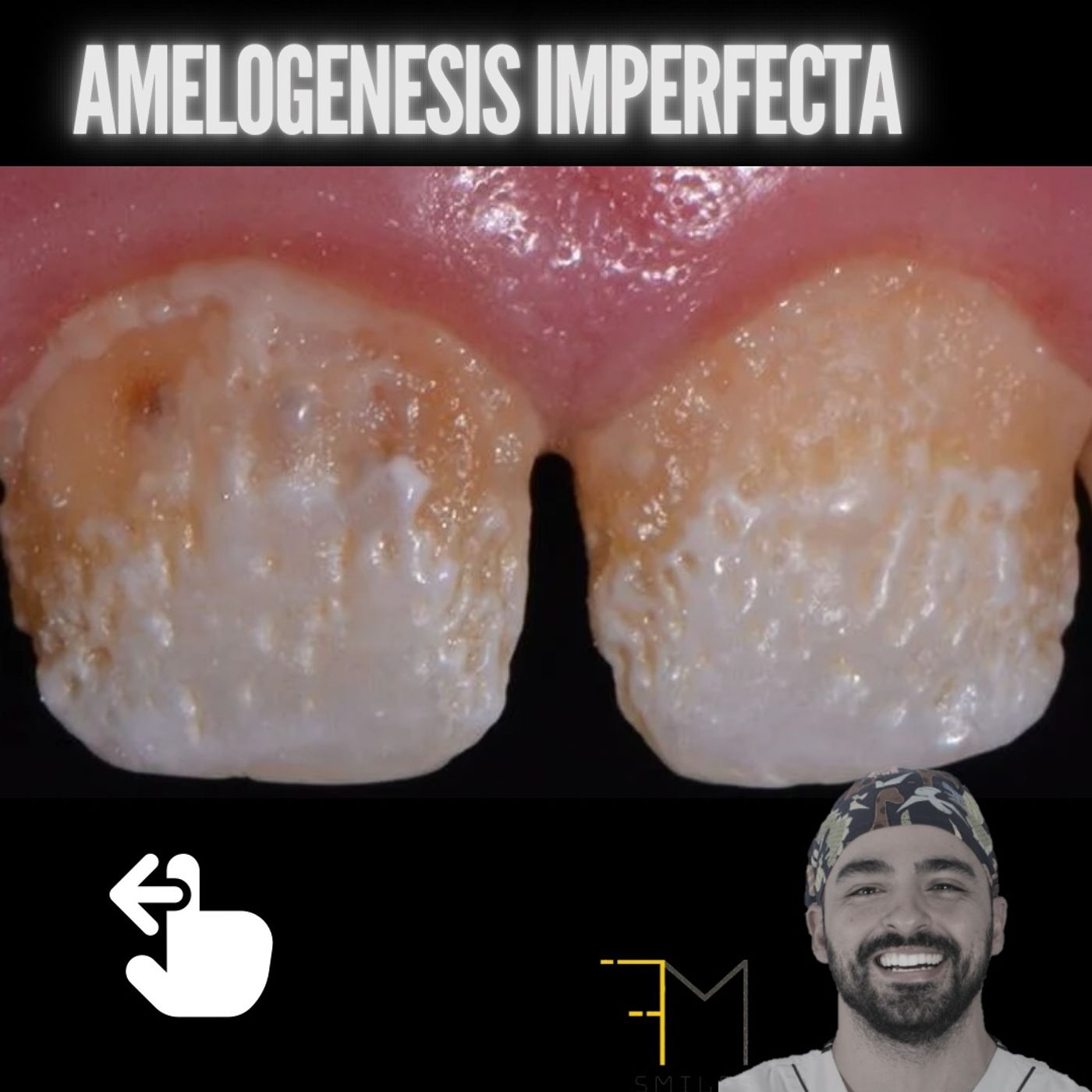 EP.9 Amelogenesis imperfecta, como reconocerla y como tratarla episode artwork