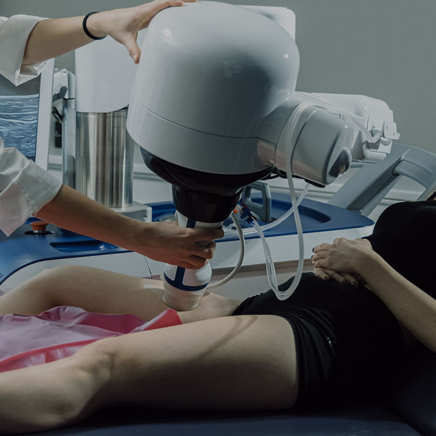 Belleza: Sonovein, ultrasonidos de alta intensidad para eliminar varices