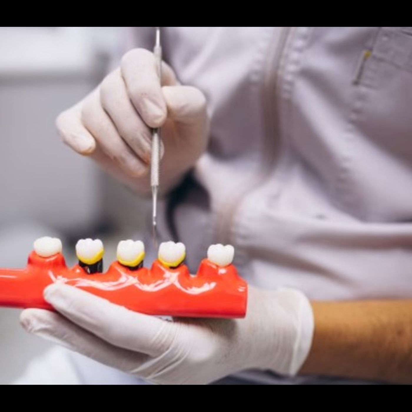 Teeth Aligners Treatment in Noida