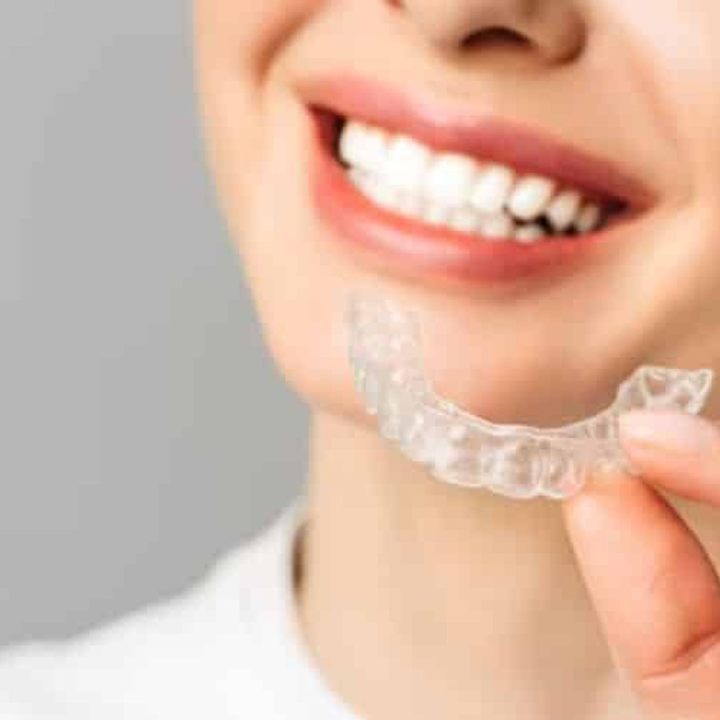 Tailored Approaches to Transform Your Smile episode artwork