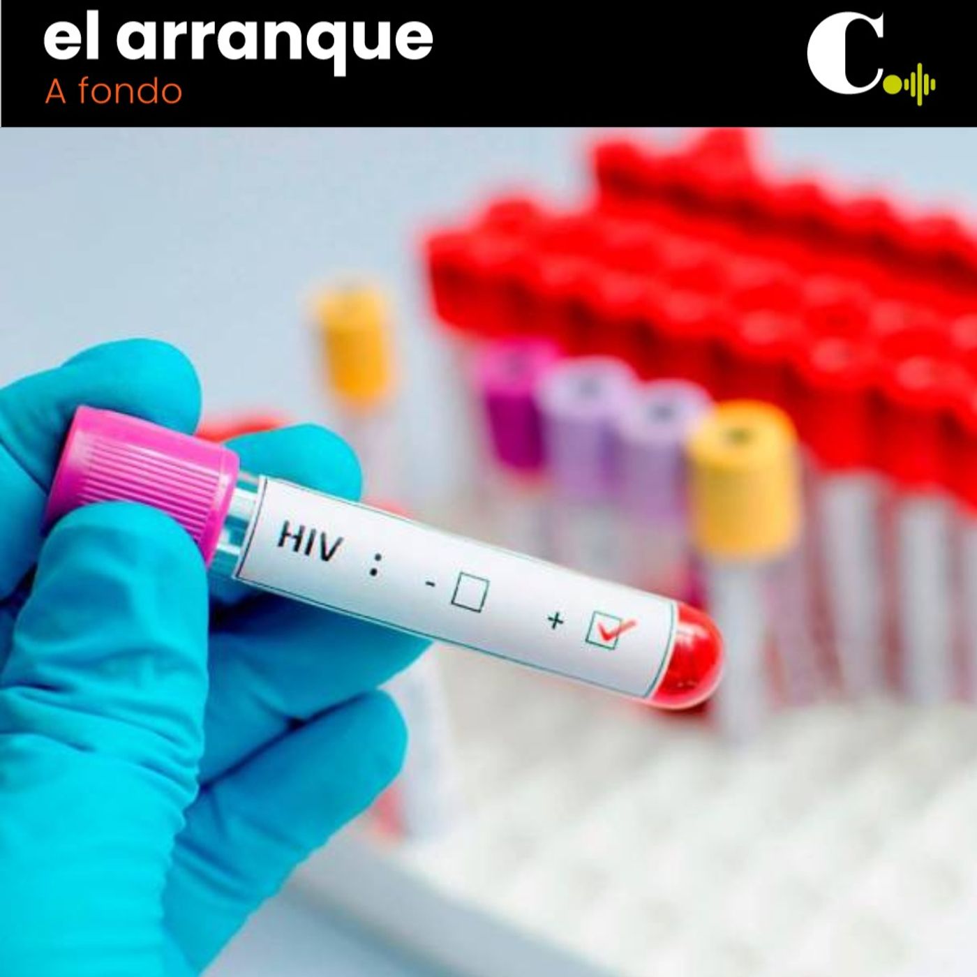456. El VIH sigue siendo una epidemia silenciosa episode artwork