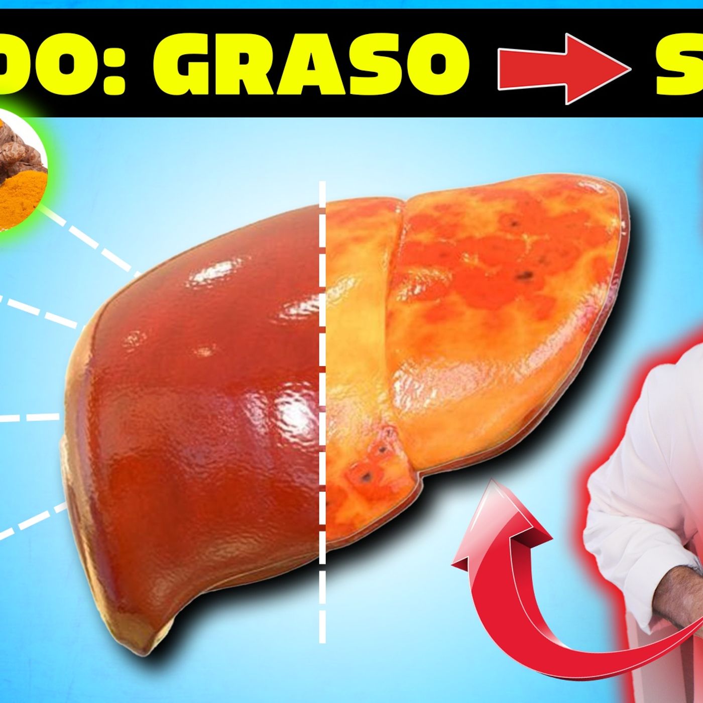 👉LISTA de ALIMENTOS, SUPLEMENTOS y ESPECIAS para ELIMINAR RÁPIDO la 🔥GRASA en el HÍGADO🔥!
