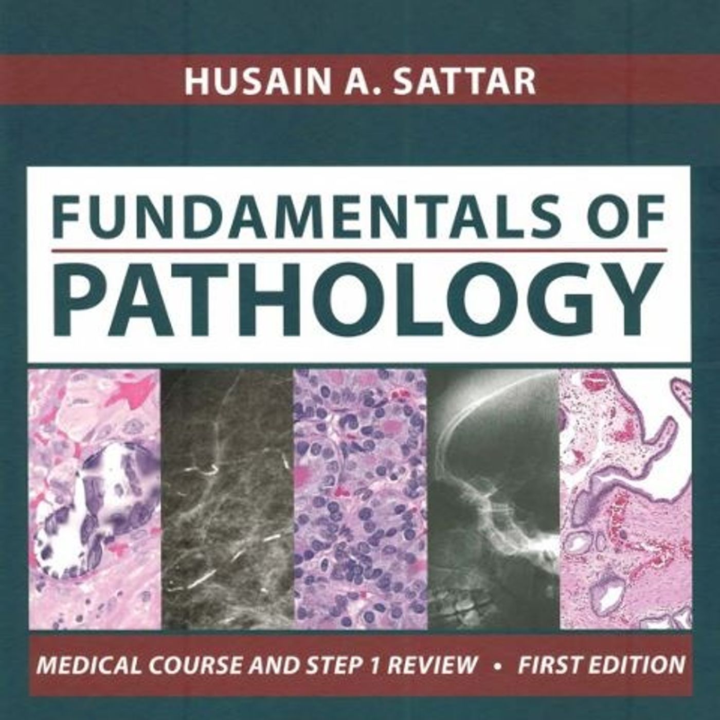 Fundamentals of Pathology
