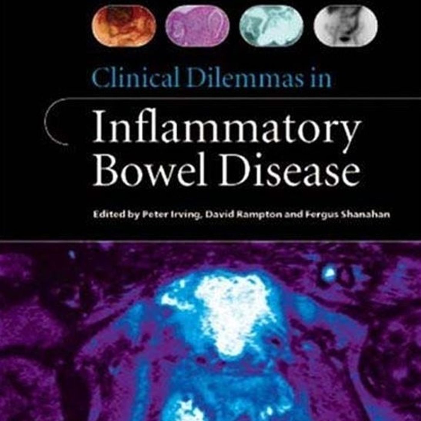 Clinical Dilemmas in Inflammatory Bowel Disease episode artwork