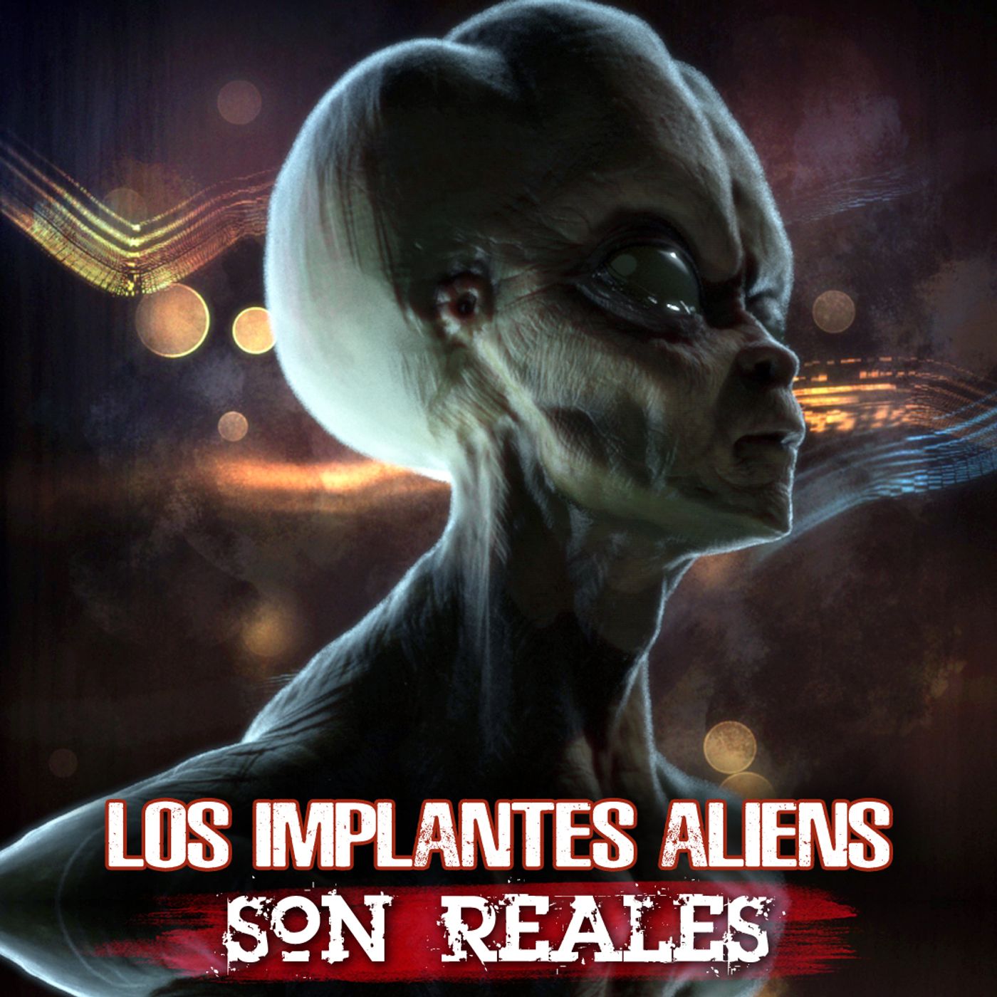 Los implantes alienígenas son reales episode artwork