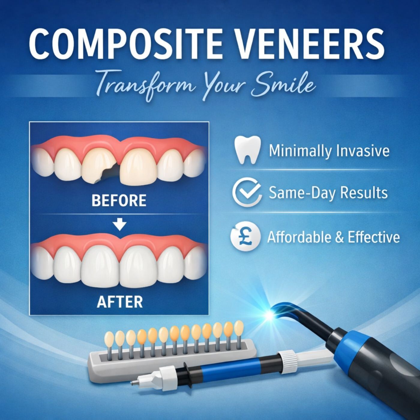 What are Composite Veneers​ and What Makes it a Better? episode artwork