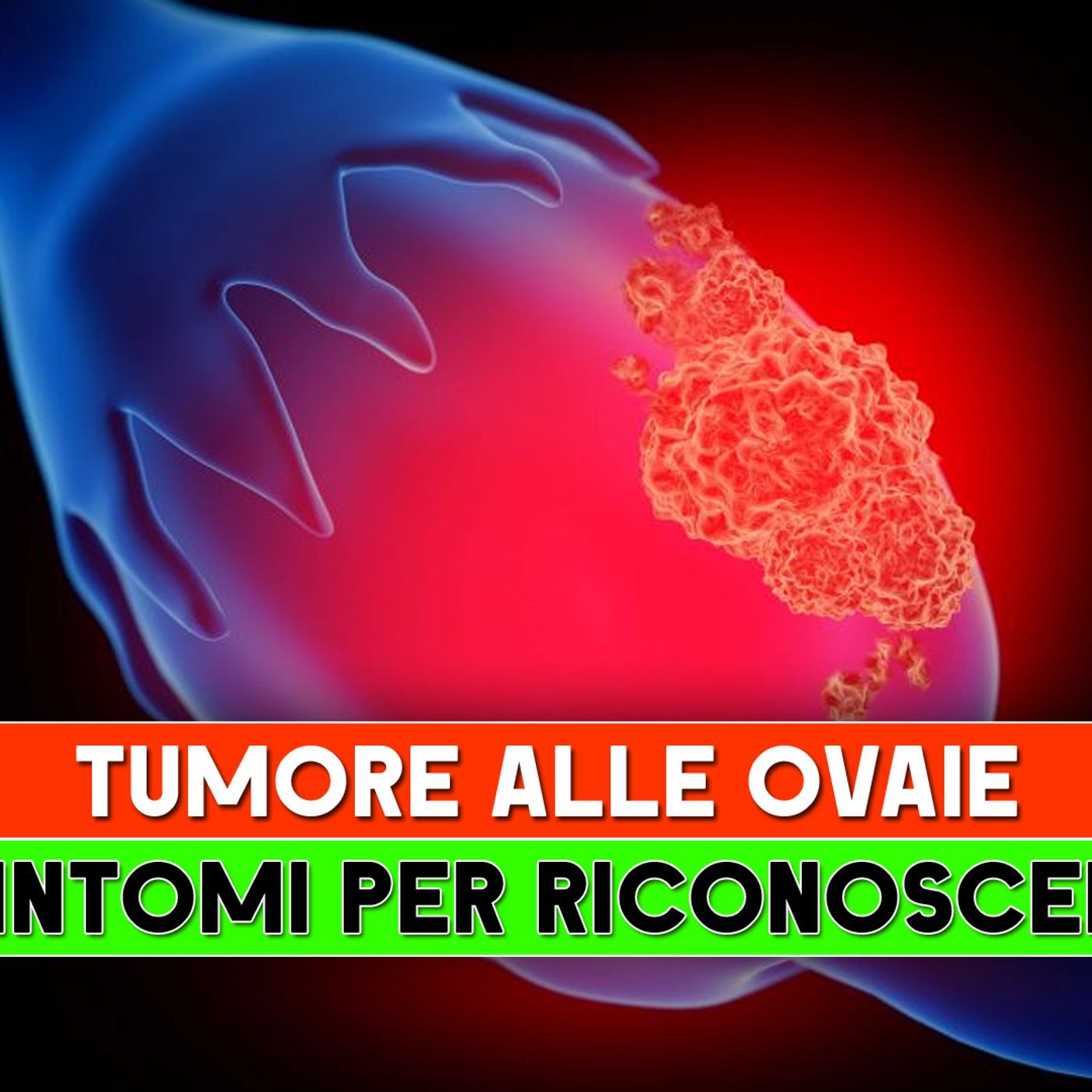 Tumore Alle Ovaie: I 5 Sintomi Per Riconoscerlo! episode artwork