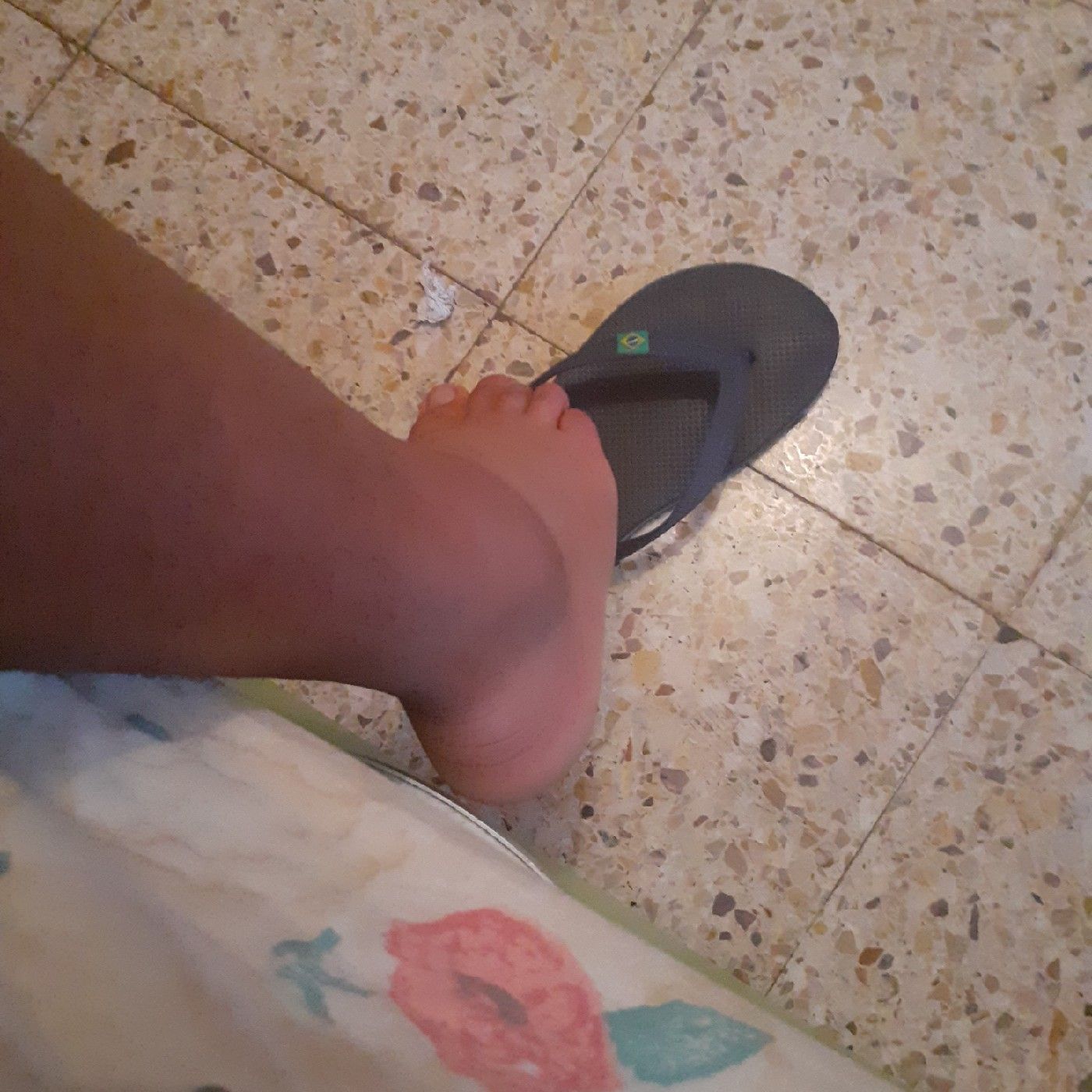 LESIÓN EN EL PIE DERECHO