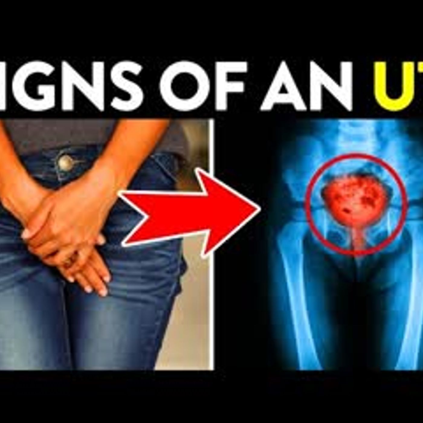 11 Sneaky Causes Of Urinary Tract Infections episode artwork