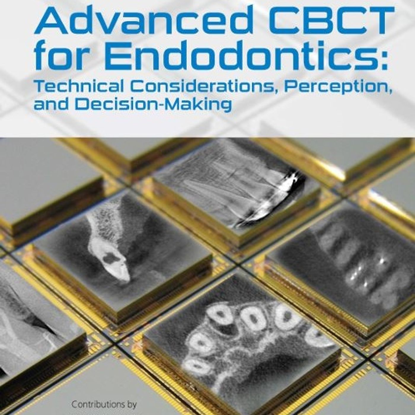 Advanced CBCT for Endodontics: Technical Considerations, Perception, and Decision-Making