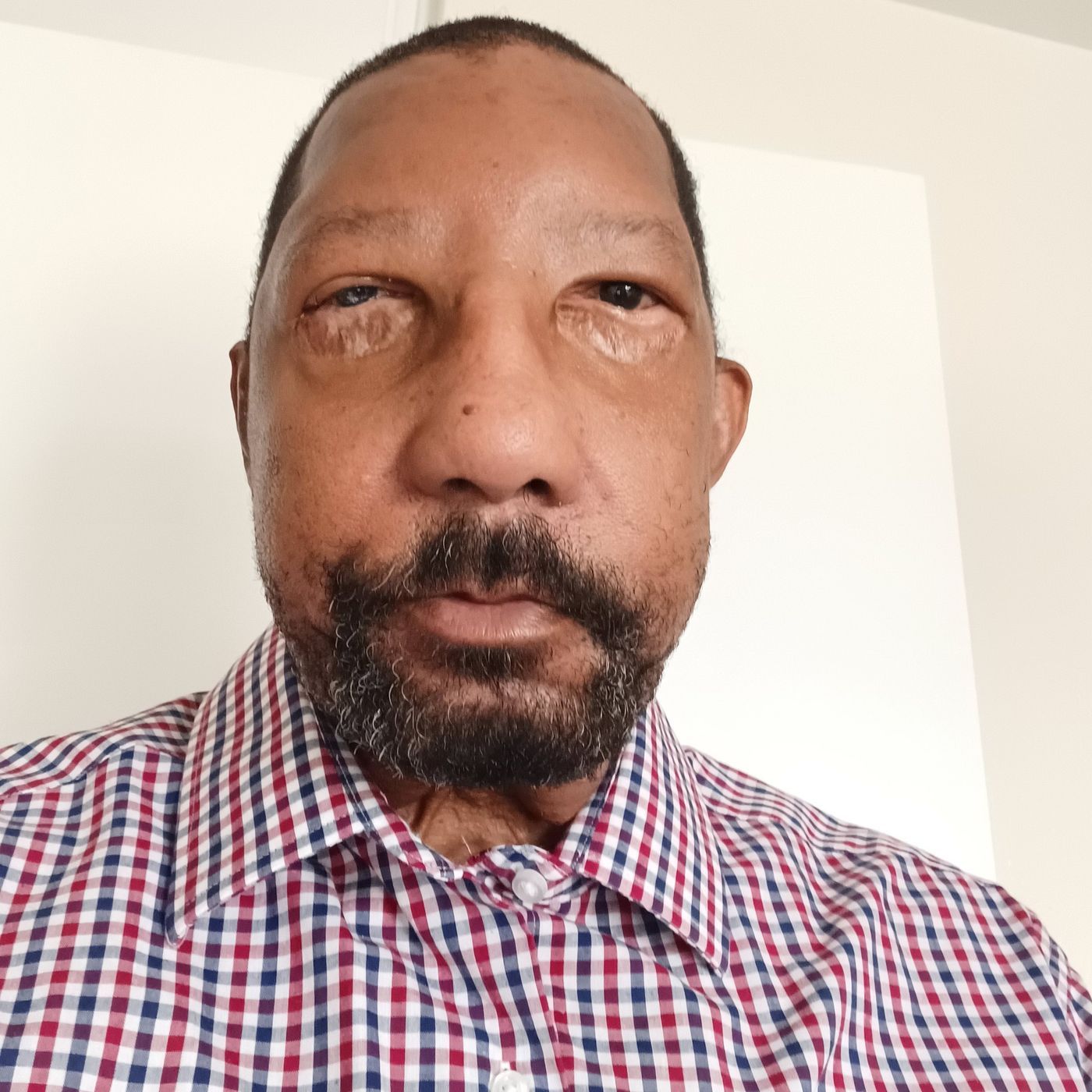The Man With a New Face