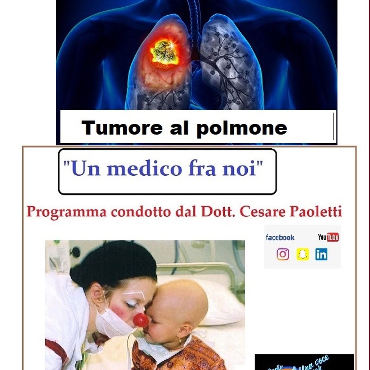 "UN MEDICO FRA NOI" Dott. Cesare Paoletti - TUMORE AL POLMONE episode artwork