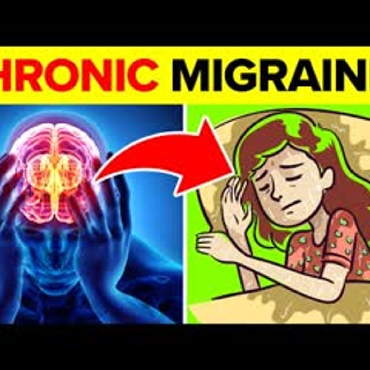 11 Common Triggers Of Chronic Migraines You Must NOT Ignore episode artwork