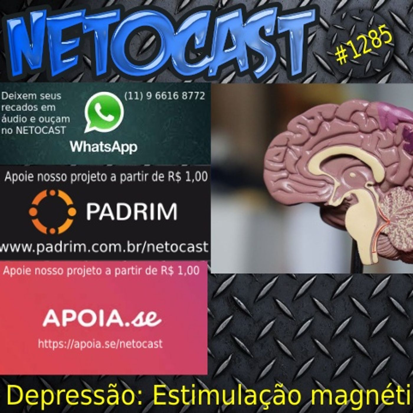 NETOCAST 1285 DE 18/04/2020 - Tratamento para depressão reduziu sintomas de 90% dos pacientes em testes