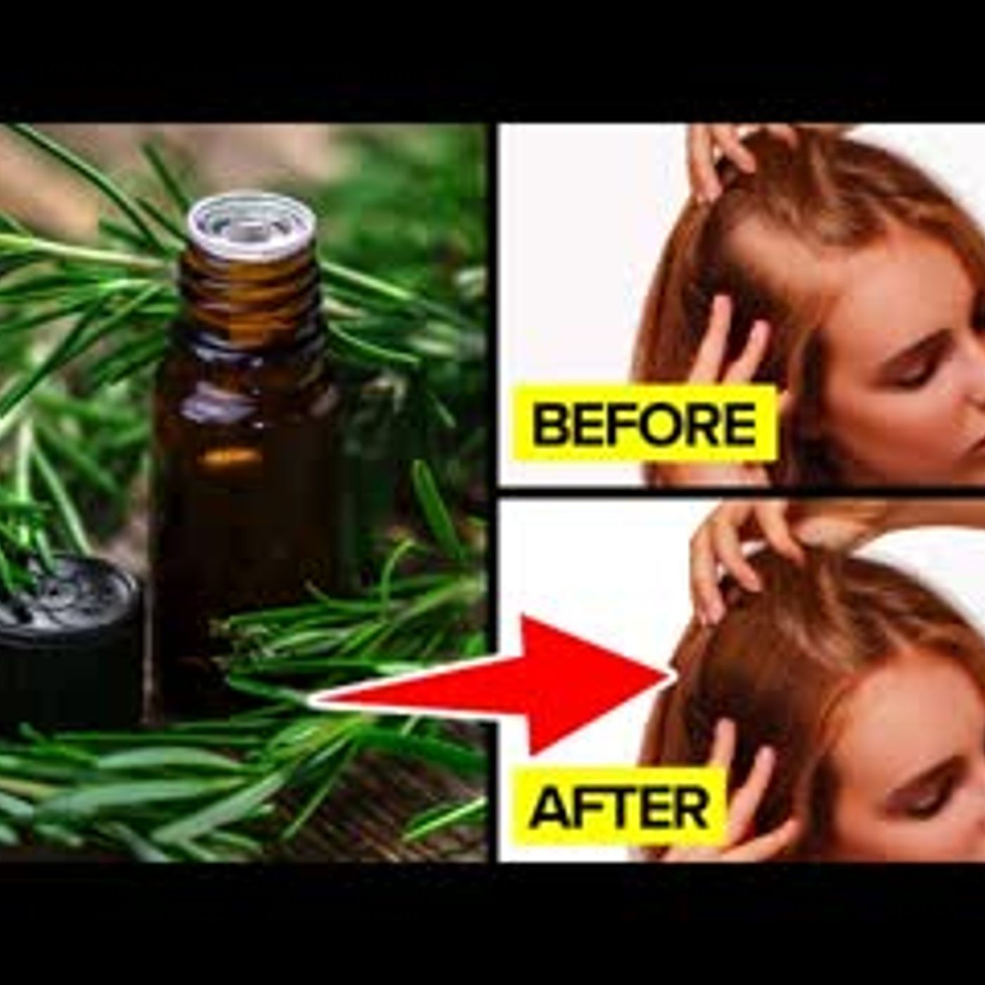 12 Benefits Of Rosemary Essential Oil To Improve Your Mental & Physical Well-Being episode artwork