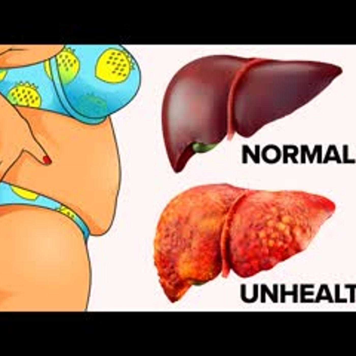 10 Warning Signs That Your Liver Is Full Of Toxins episode artwork